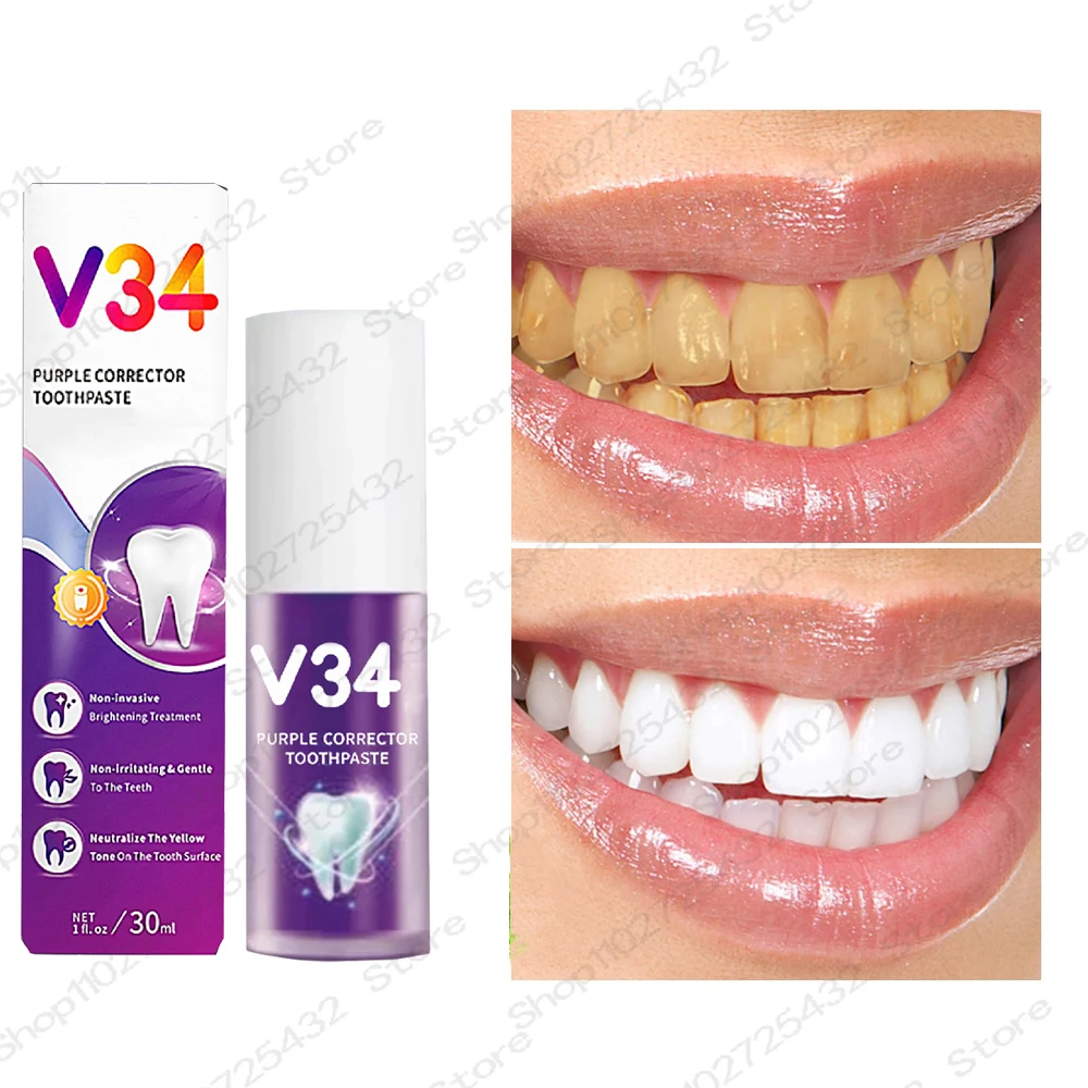 Mousse de soin dentaire, Essence, élimine la Plaque dentaire, réparation gingivale, prévention des caries, nettoyage buccal, 30m_voghion.com