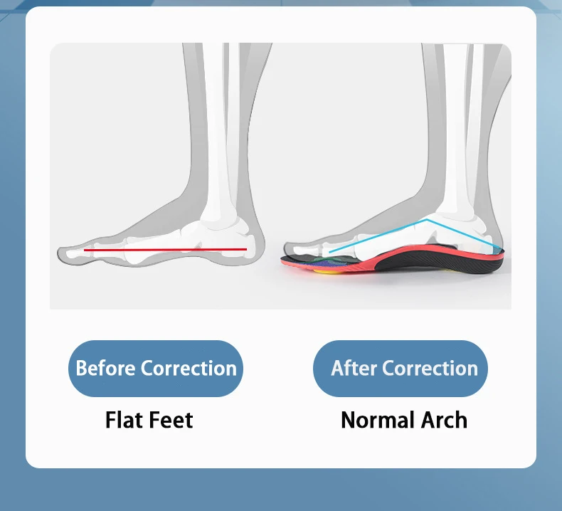 1 Paar Fußgewölbestütze, Einlegesohlen bei Plantarfasziitis, weiche Sohle, stoßdämpfende Einlegesohlen für Sportschuhe, orthopädische Einlegesohlen für Plattfüße, unisex. – Detail 5