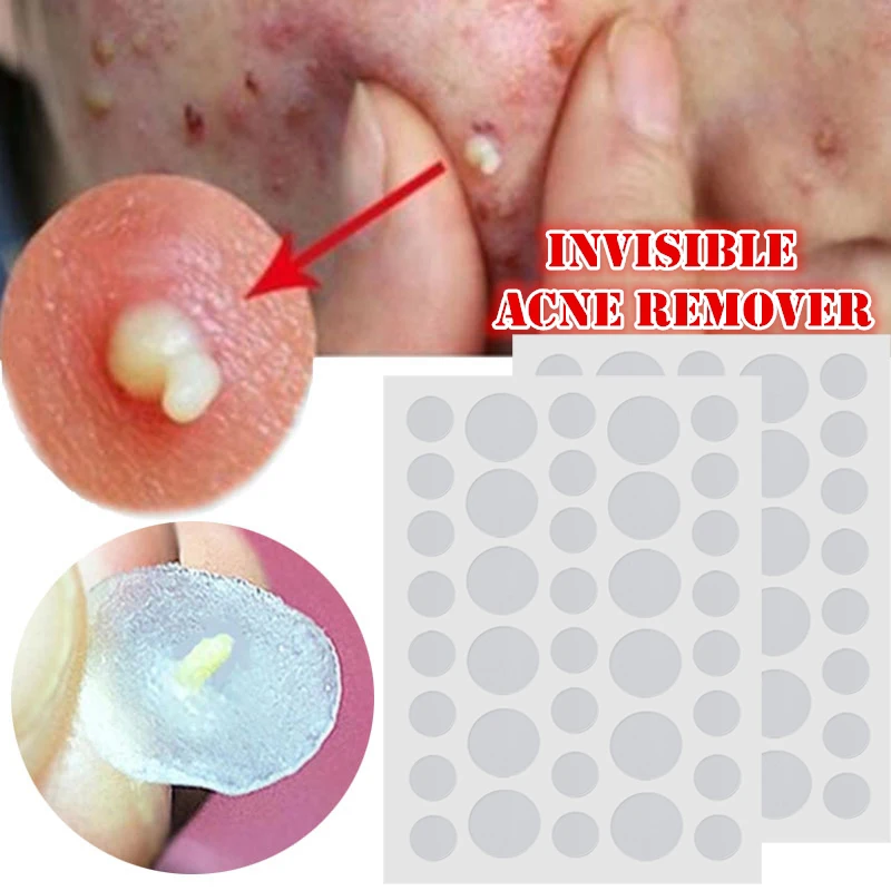 36pcs/sheet Invisible Acne Patch Waterproof Skin Tag Remover Pimple