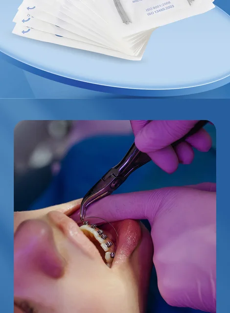 Fili Dentali Super Elastici 50 Archi Ortodontici Rotondi In Niti - Foto 12