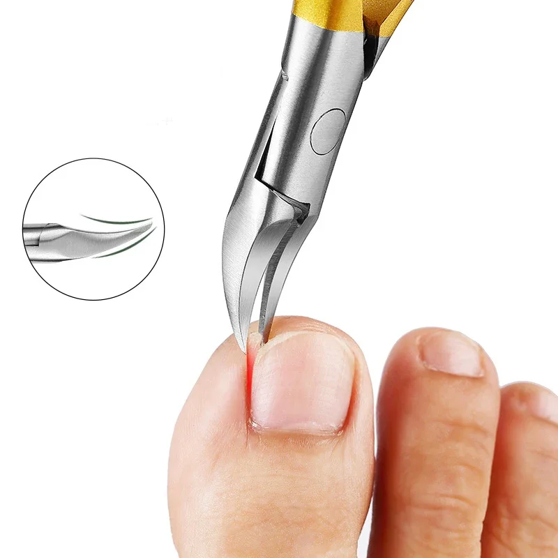 Nail Clippers Ingrown Toenail Scissors Podiatry Correction Nippers Cuticle Cutters Cut Paronychia Pedicure Foot Care Tool toe nail clipper,nail clipper set,nail clipper,nail care kit,nail scissors set,nail clippers,manicure pedicure kit,manicure set,manicure sets,manicure nail clipper set