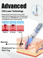 The first generation of improved  ᴡᴀʀᴛ ʀᴇᴘᴀɪʀ ᴀɢᴇɴᴛ ᴡᴀʀᴛ ʀᴏᴏᴛ ғᴀsᴛ 3