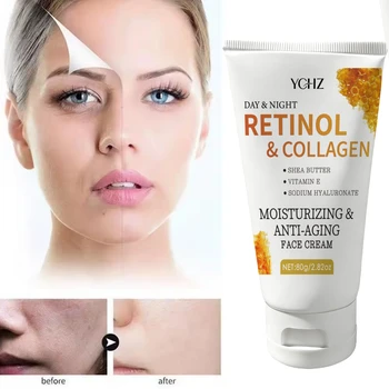 Retinol Facial Anti-Aging Cream: Anti-Wrinkle Cream for Face and Neck, Contains Collagen and Hyaluronic Acid - Night Moisturizer for Men and Women - 80g 1