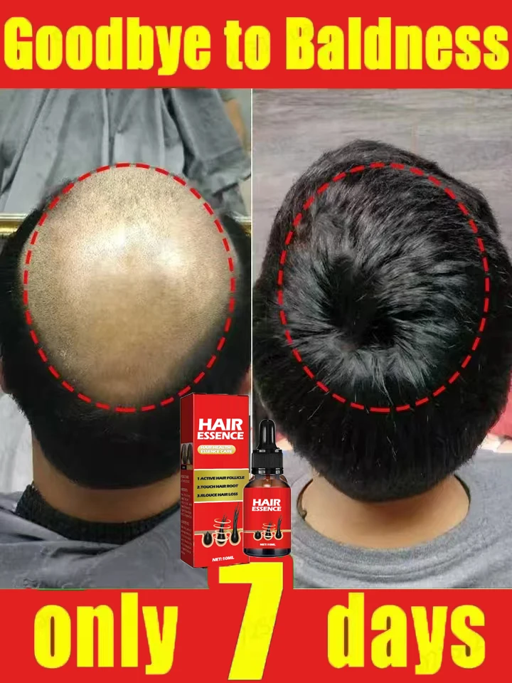 Dites Alfa &agrave; l'amincissement des cheveux, au soin des cheveux, &agrave; la r&eacute;paration et la pr&eacute;vention de l'amincissement cheveux