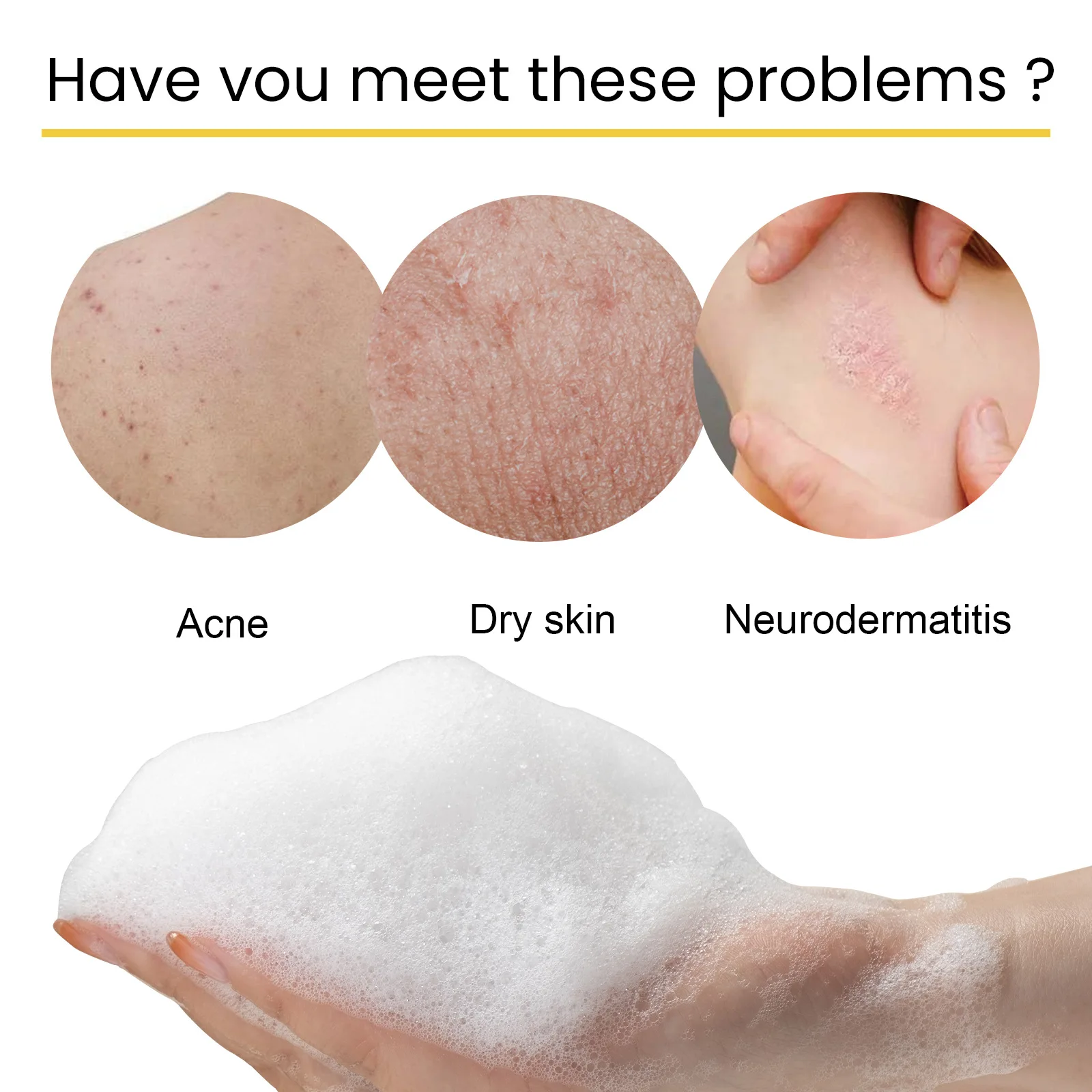 Рисунок 3 - Увлажняющее Отбеливающее мыло для лечения псориаза