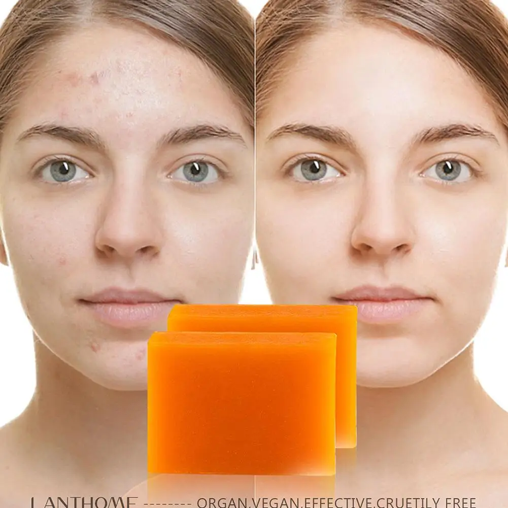 Рисунок 5 - Отбеливающее мыло ручной работы