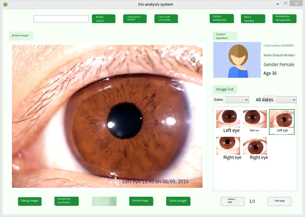 Iridology Analyzer