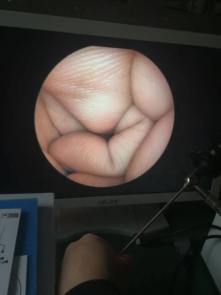 thumb
