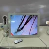 2025HD Digital Skin Analyzer Professional Hair Scalp Camera Detector Hair Follicle Oil Moisture Test Device 15inch 1