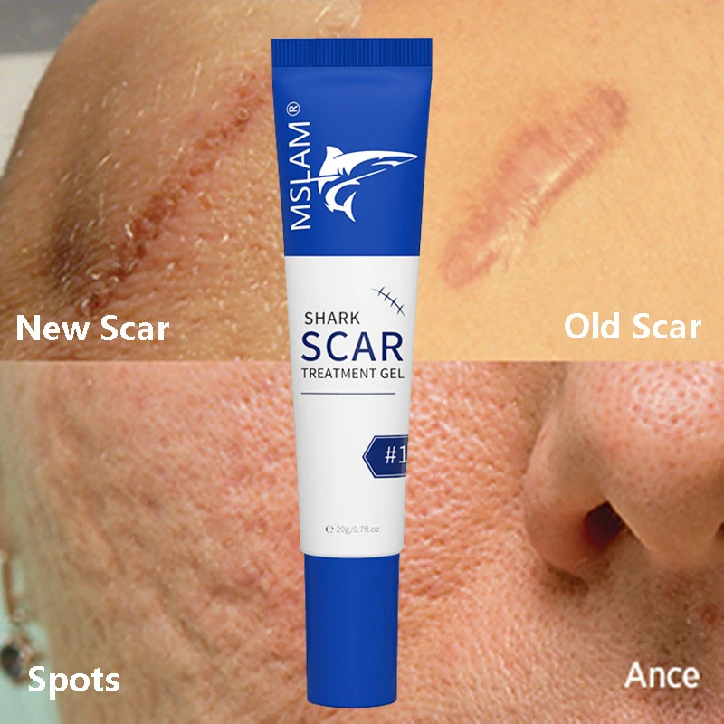 Scar Removal Cream Gel Remove Acne Spots Treatment Stretch Marks Burn