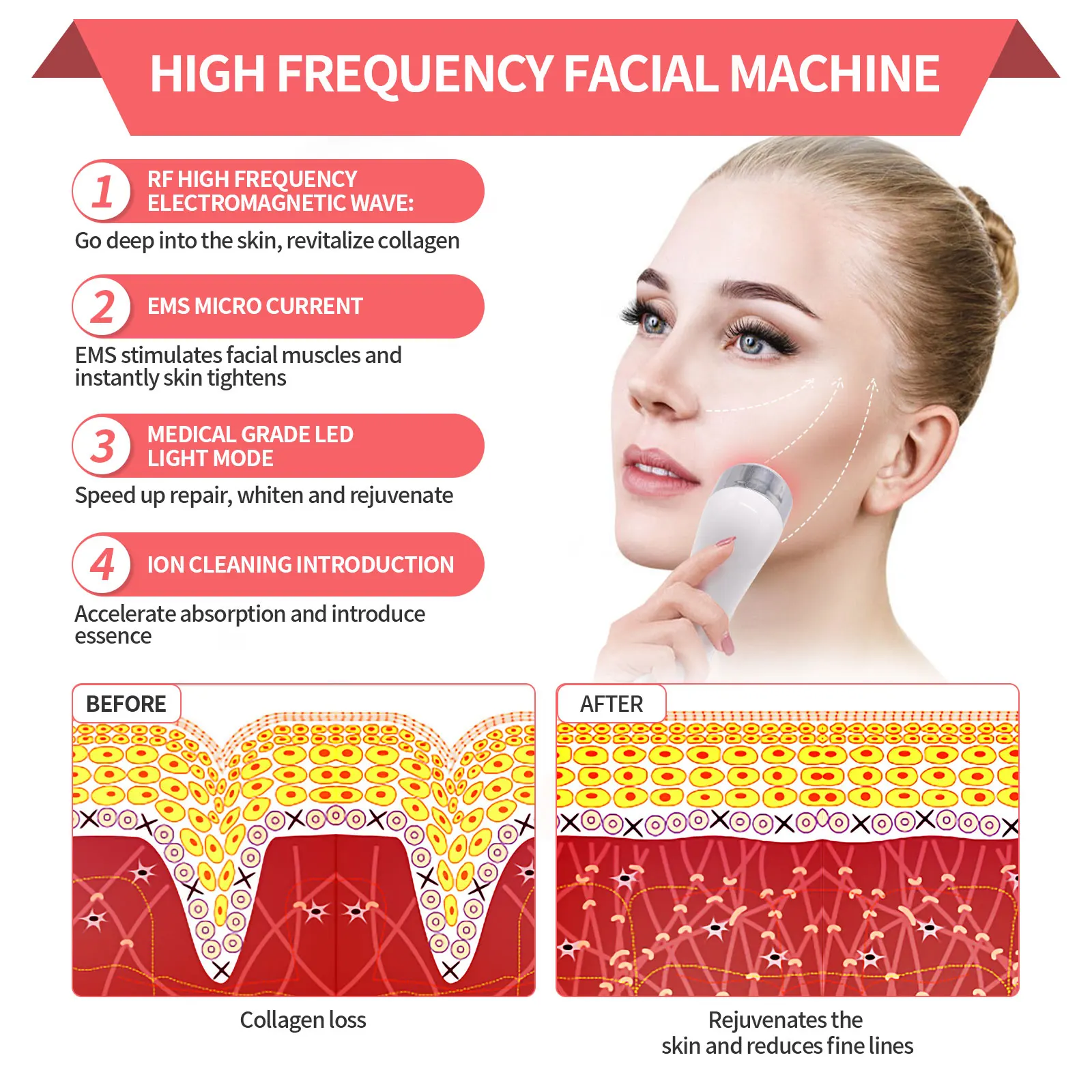 Rechargeable Handheld RF EMS LED Beauty RF Face Lift Machine