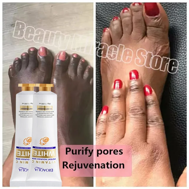 Fast Whitening Dark Knuckles Brighten Hand Cream Melanin Corrector Moisturizing Intense Stains Remover Products Skin Care 5