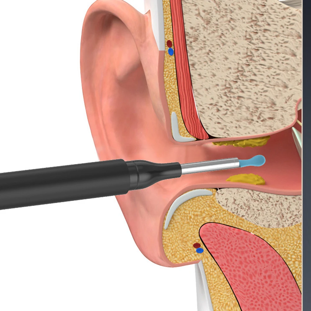 Wireless Ear Wax Cleaner With Camera Smart Visual Ear Picking Stick Built In Ear Hook/Ear Spatula/Ear Spoon Ear Wax Remvoal Tool 4