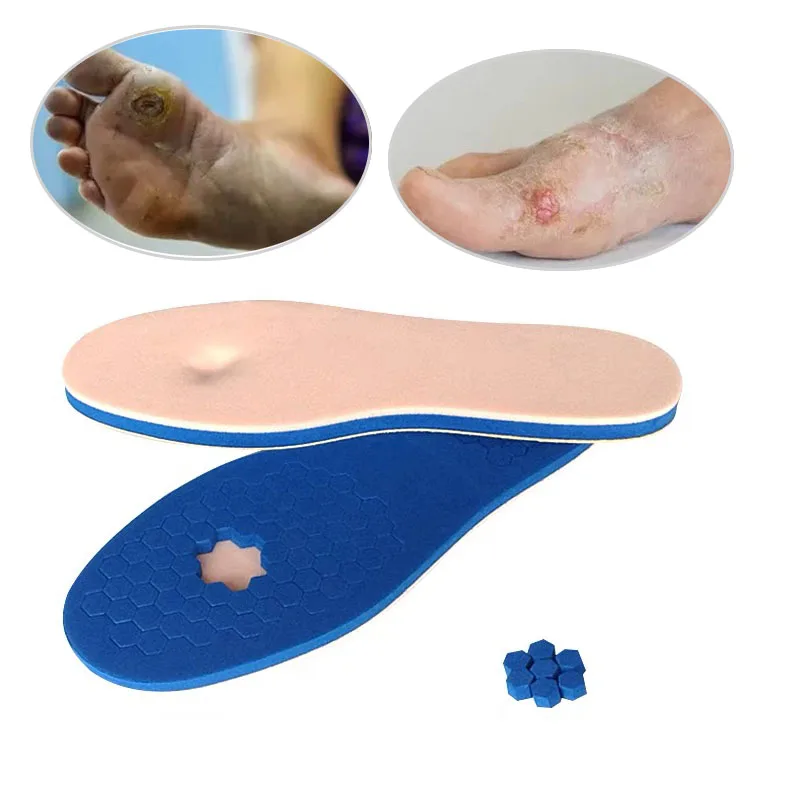 Diabetic Foot Ulcer Insoles For Peripheral Neuropathy