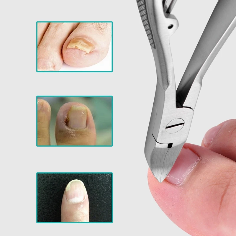 Nail Clipper Nail Clippers Toe Nail Clipper Professional Feet Toe Nail Clippers Trimmer Cutters Paronychia Nippers Chiropody Podiatry Stainless Foot Care Tools