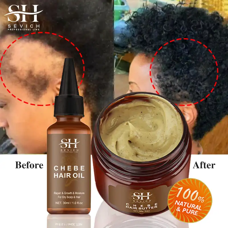 100g Fast Hair Growth Set Traction Alopecia Chebe Hair Mask Anti Hair Break Hair Growth Oil Hair Loss Treatment Hair Care Sevich