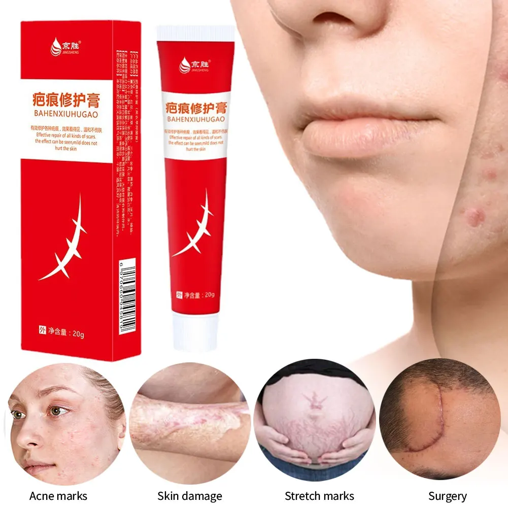 Scar Removal Cream Gel Remove Acne Spots Treatment Stretch Marks Burn Surgical Scar Repair Cream Smoothing Whitening Skin Beaut