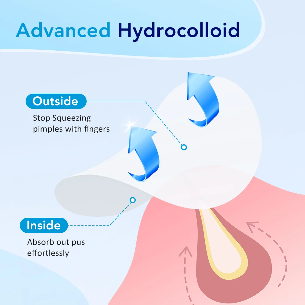 Invisible Hydrocolloid Acne Patches for Face and Body