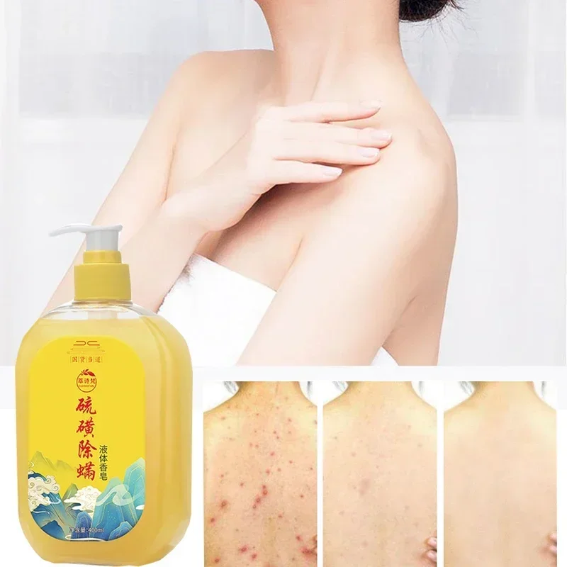 Body lotion body wash 400/500ml sulfur mite bath lotion deeply cleans acne inhibits bacteria relieves itching refreshes moistens liquid