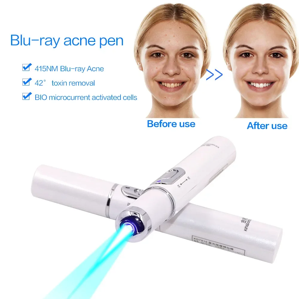 Acne Laser Pen Against Face Remove Varicose Veins Black Dots Blue Light Skincare Anti-Wrinkle Skin Care Beauty Appliances Plasma laser skin treatment