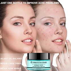 PRETTYCOME Acne Cream Herbal Anti-Acne Fade Acne Spots Scars Oil Control Whitening Moisturizing Brighten Face Care Cosmetics
