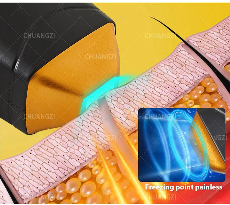 2024 The latest diode laser professional hair remover three-wavelength 755 808 1064NM ice titanium painless permanent