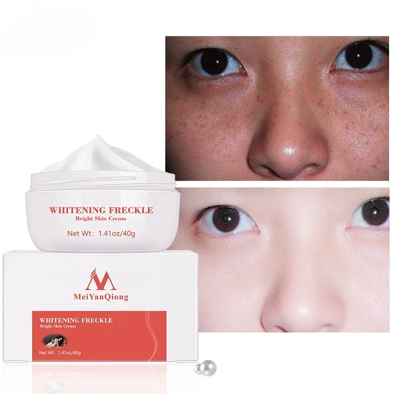 

Facial Powerful Whitening Cream Remove Freckle Cream Fade Acne Spots Melanin Dark Spots Face Lift Firming Beauty Skin Care 40g