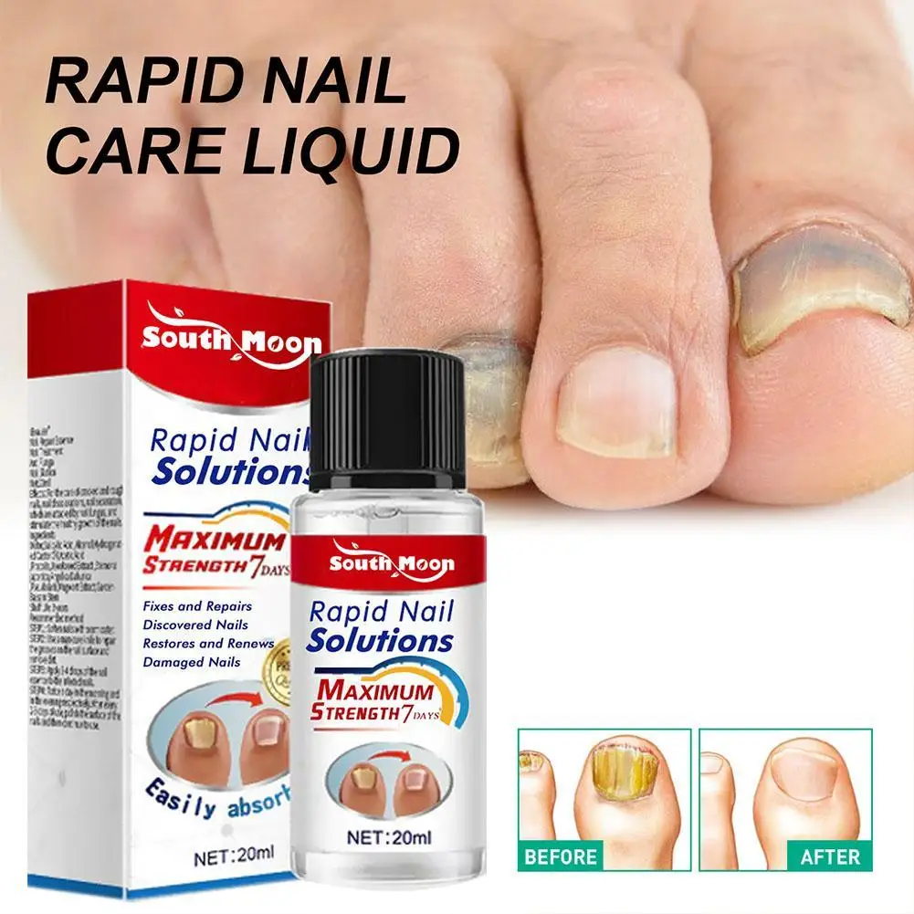 

Nail Fungal Treatment Serum Anti Infection Onychomycosis Paronychia Rapid Repair Gel Toe Nail Fungal Fast Removal Hand Foot Care