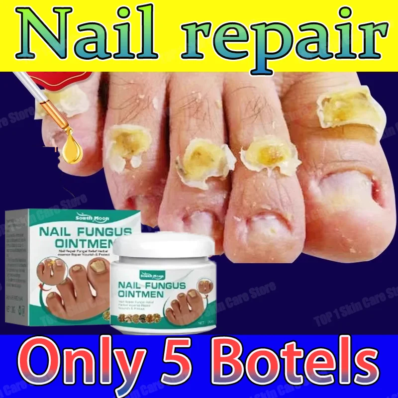 Fungal Nail Treatment Oil Foot Repair Essence Toe Nail Fungus Removal Gel Anti Infection Cream Fungal Removal