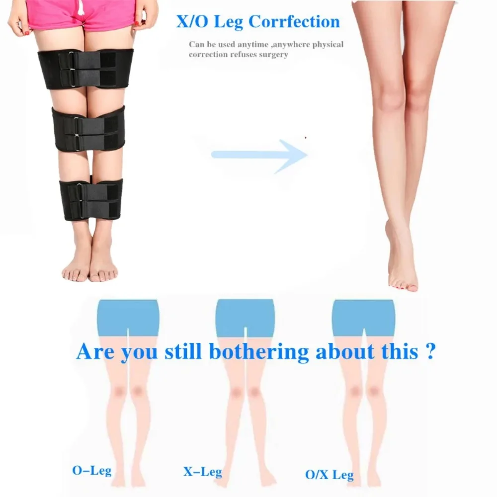 Effective O-leg X Type Leg Bowed Legs Knee Valgum Straightening Correction Band Posture Corrector Beauty Leg Band Belt 종아리압박밴드