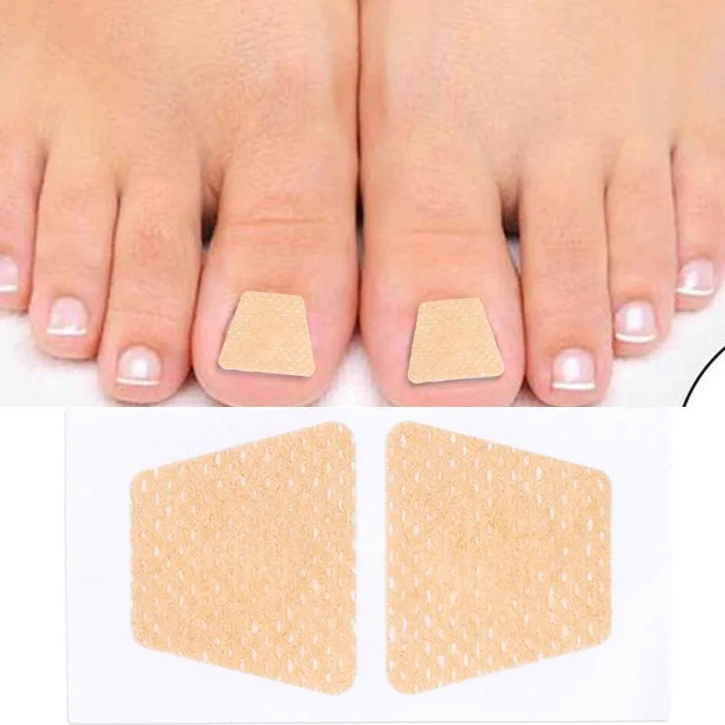 Fabric Ingrown Toenail Correction Stickers for Foot Health Care