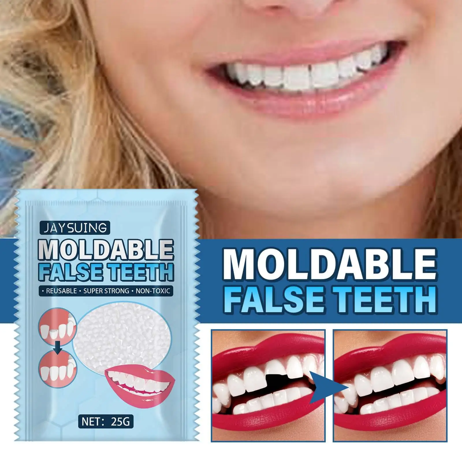 25g Temporary Tooth Repair Kit Denture Adhesive Tooth Filling Thermal