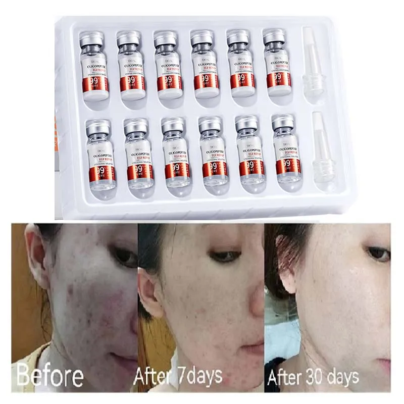 12Pcs/box Oligopeptide Repair Freeze-dried Powder Set Facial Skincare Anti-aging Moisturizing Brightening Face Serum Skin Care