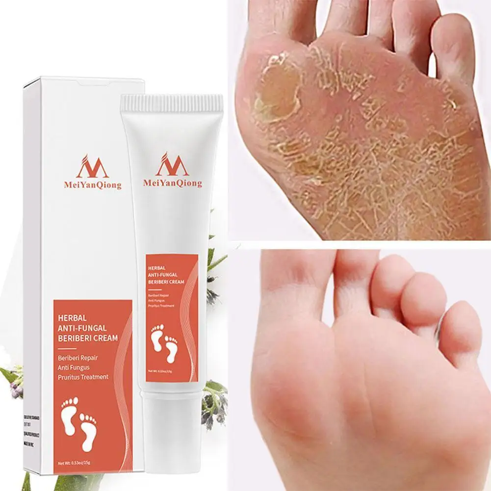 

Foot Care Cream Foot spa Pedicure Herbal Detox Anti Fungal Infection Onychomycosis Fungus Treatment For legs