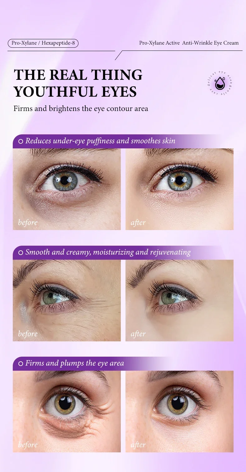 Instant Eye Bag Removal Cream Retinol Anti-Wrinkle Firming Skin Fade Fine Lines Anti Dark Circle Puffiness Brighten Eye skinCare