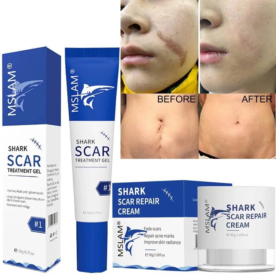 2pcs Scar Removal Cream Gel Remove Acne Spots Treatment Stretch Marks
