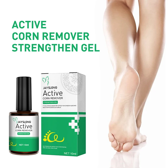 10ml Remove Foot Corn Care Cream Remove Foot Calluses Remove Warts