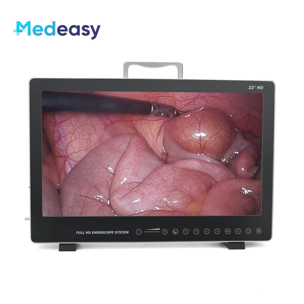 近畿　Live Endoscopy DVD付き Amazon.co.jp: 近畿 Live Endoscopy 2017-2018[DVD付] : 近畿内