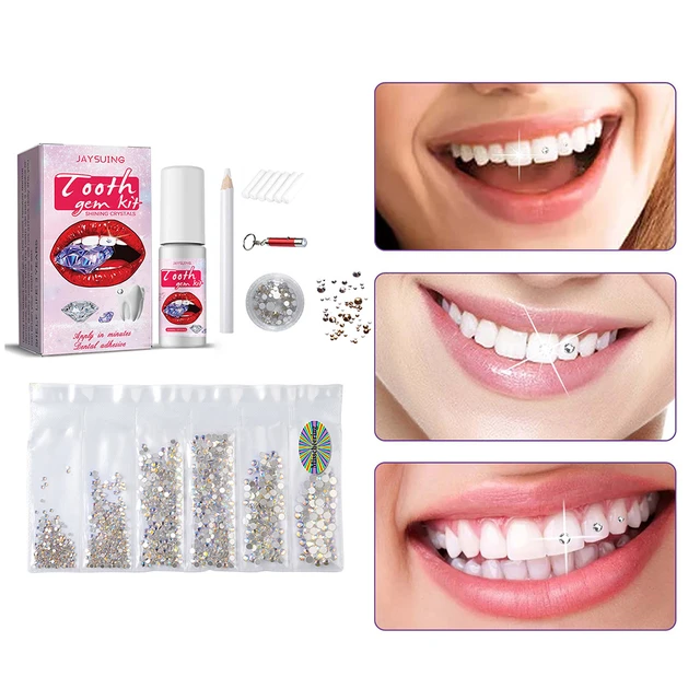 DIY Tooth Gems Kit with Crystals Multifunctional Tooth Jewelry Gems Kit  Sturdy with Curing Light Glue Professional Ornament - AliExpress