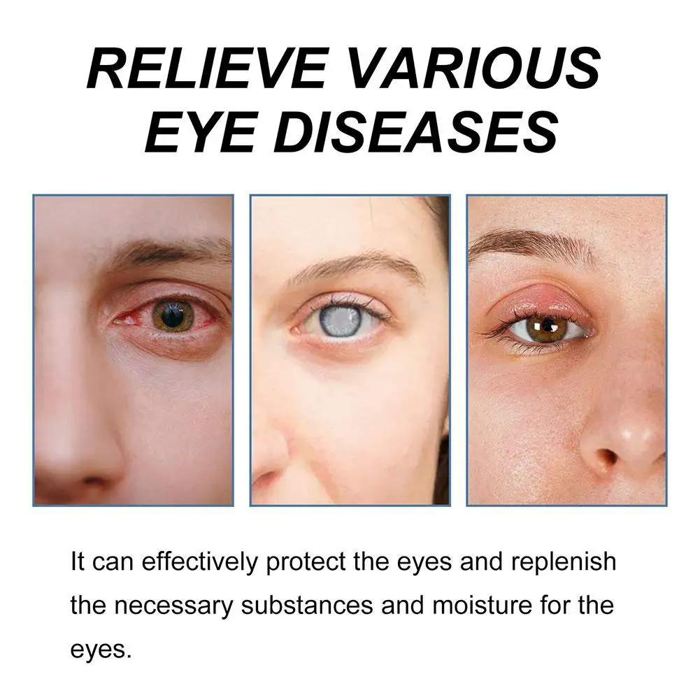 Eye Drops 1PC Cataract Removal Eye Drop Improve Blurred Vision Itching Eyeball Relieve Infection