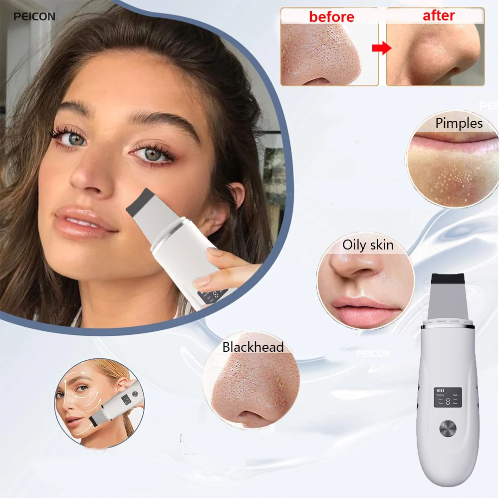 Facial Ultrasonic Spatula Skin Care Blackhead Remover Ultrasonic Skin Scrubber Deep Face Care Cleansing Spatula