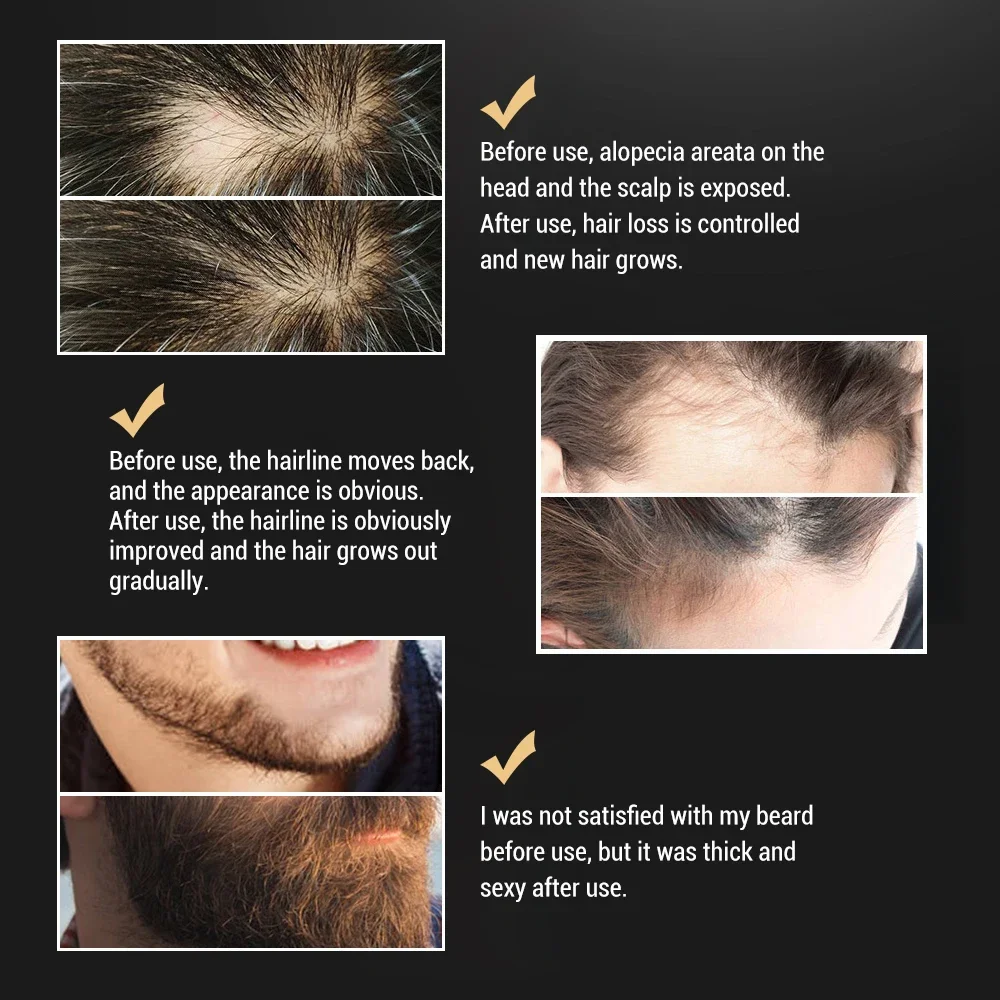 Beard Oil For Men Image 3