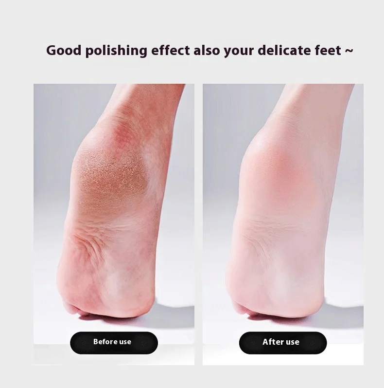 Foot Grinding Pedicure Foot File, Rasp, Heel Scraper, File And Callus Remover For Feet, Scrubber For Dead Sk