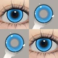 KL 14.2mm