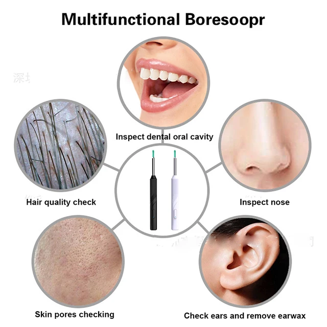 Wireless Visual Ear Pick Camera Ear Wax Removal Tool Picker  Earwax Cleaning Endoscope Kit Spoon Earpick 5