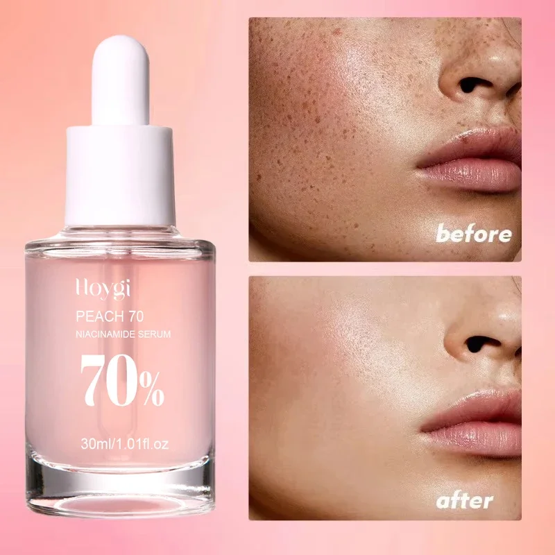 30ml Peach 70% Niacinamide Serum Moisturizing Prevent Dryness Facial Essential Oil Increasing Elasticity Smooth Soften Skin Care 5