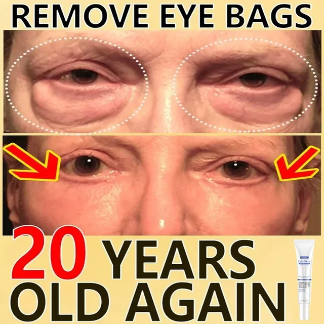 Eye Cream Removes Dark Circles Tightens The Eyes Lifting Firming And Removing Eye Bags Make Your Eyes More Lively
