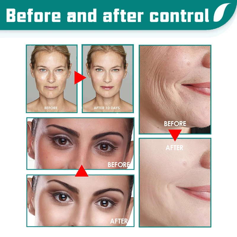 Retinol Lifting Uppstramande ansiktskräm Ta bort rynkor Anti-aging blekna Fina linjer Fuktighetskräm Ljusande hudvård Koreansk_voghion.com