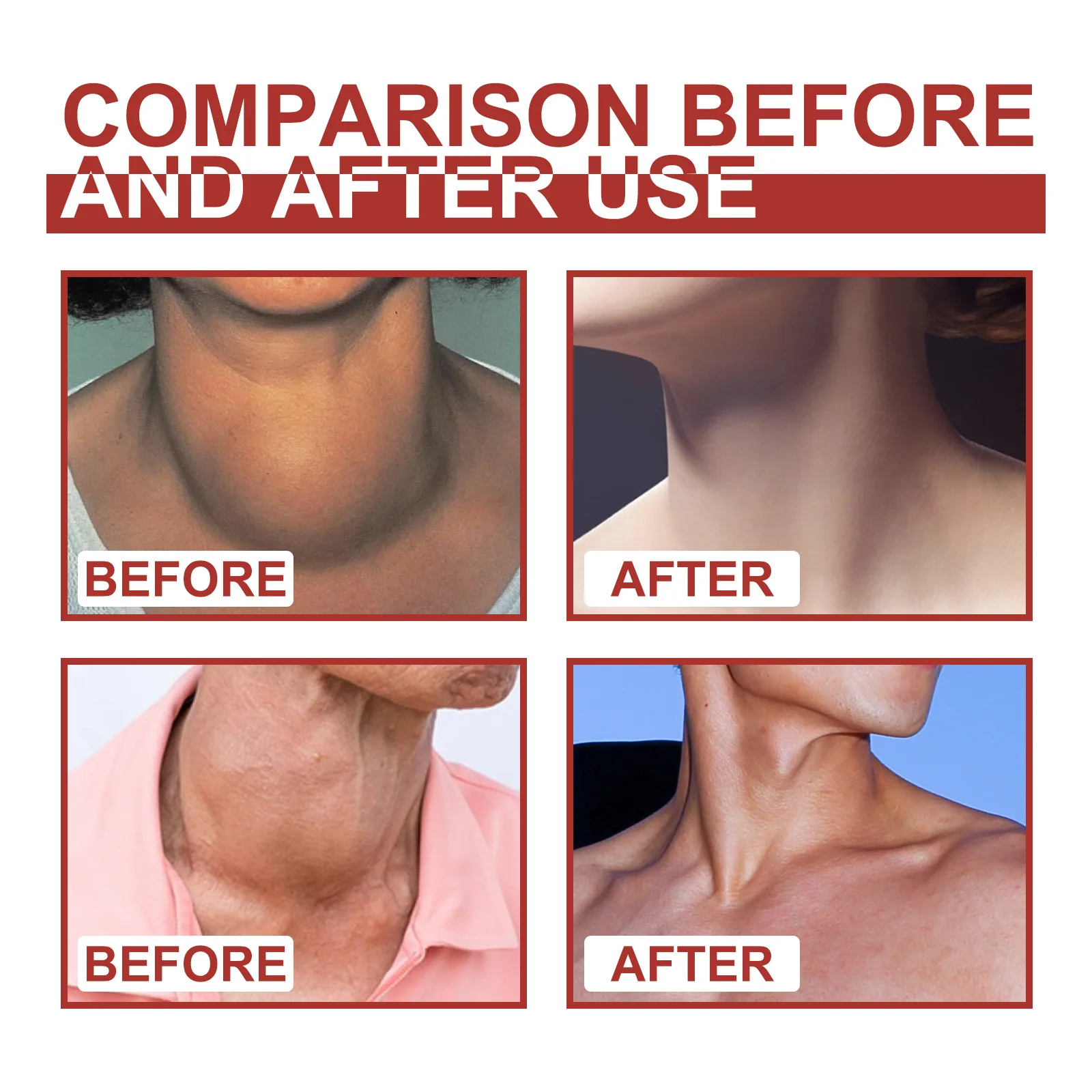 Lymphatic Detox Patch Drainage Thyroid Gland Stickers Effective Painless Treatment Heating Neck Anti Swelling Lymph Node Patches_voghion.com