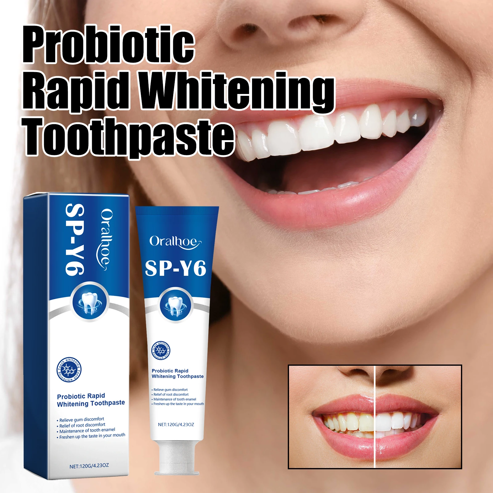 Oralhoe probiotic whitening toothpaste,Oral cleaner,Tooth Color Correction,Care For Oral Health Teeth Whitening Toothpaste